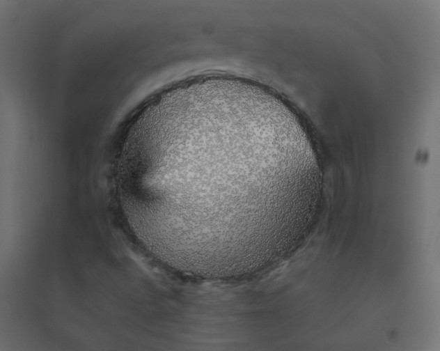 X0000094461496200711211529