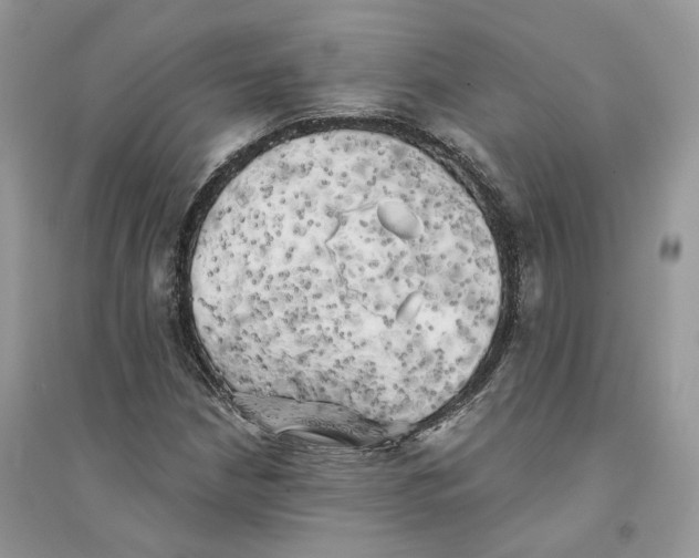 X0000094461210200711291714