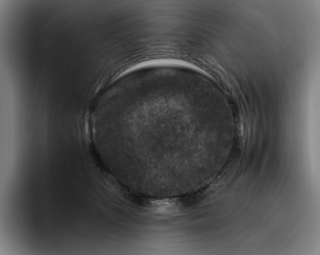 X0000094780516200711161418