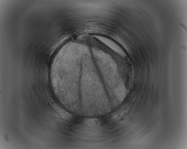 X0000094780446200712141624