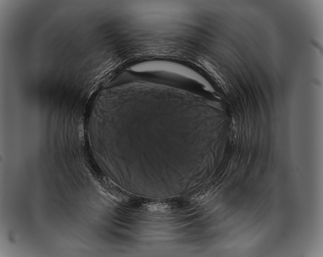 X0000094780500200712141623