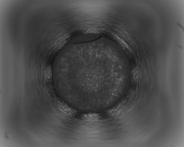 X0000094780517200712141623