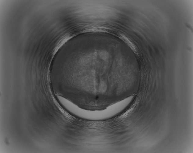 X0000094780893200712141617