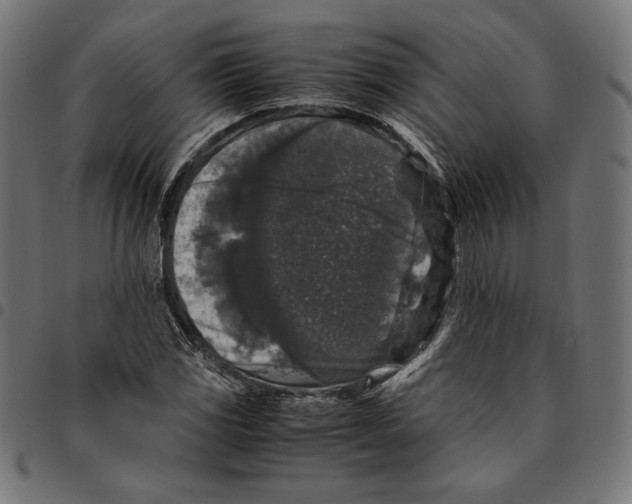 X0000094781117200712141614