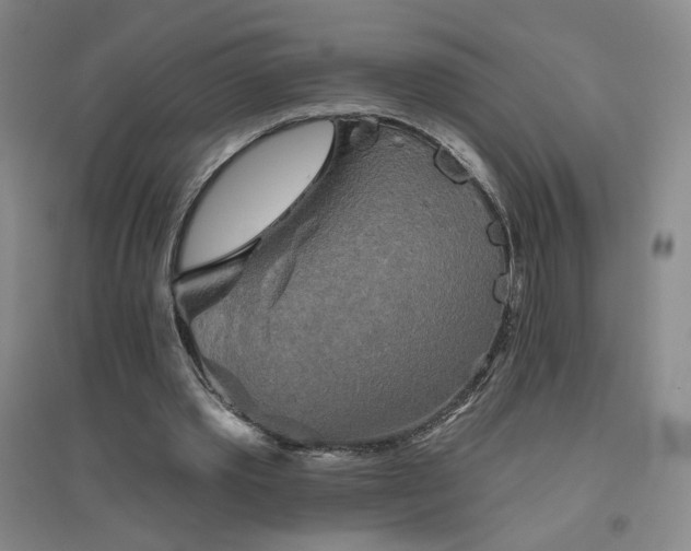 X0000094790389200711161438