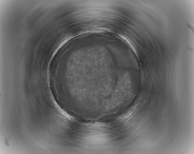 X0000094790851200712071227