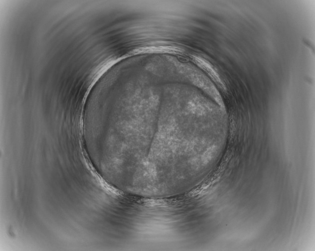 X0000094790852200712071227