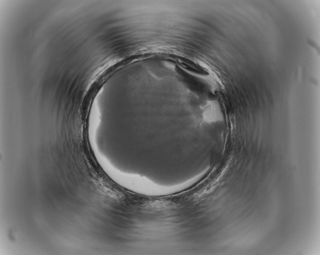 X0000094791117200712071222