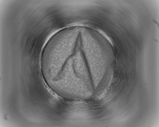 X0000094791148200712071222