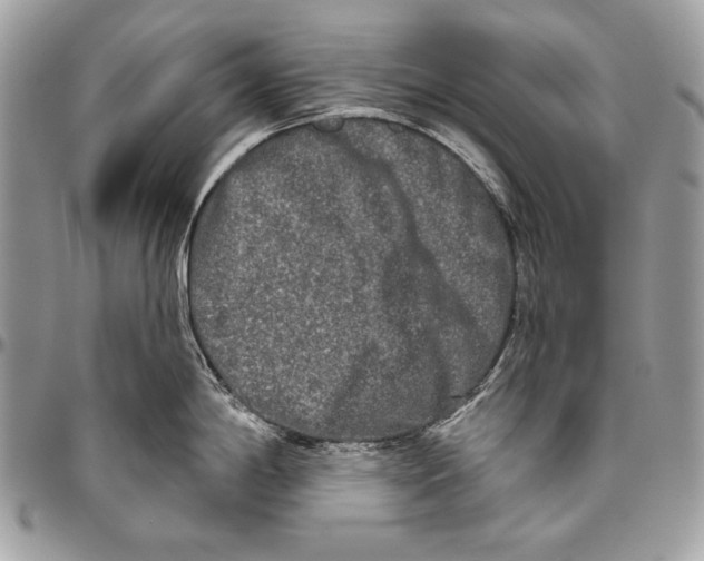 X0000094791198200712071221