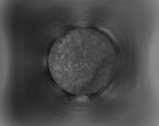 X0000094790576200712141640