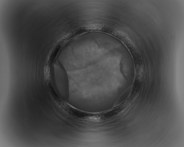 X0000094790692200712141638