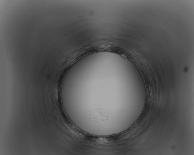 X0000094810562200711161006