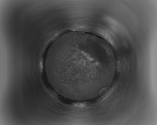 X0000094810358200711161512