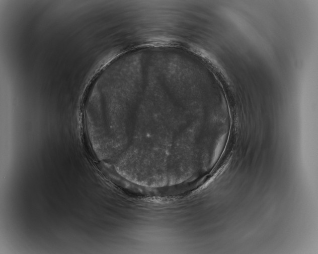 X0000094811362200712071217