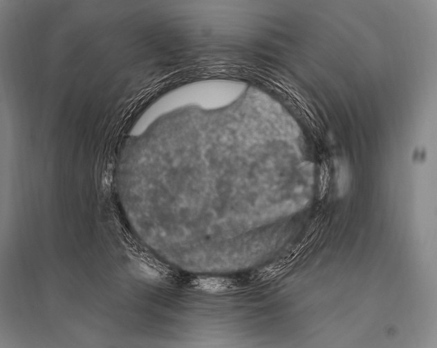 X0000094810417200712141626