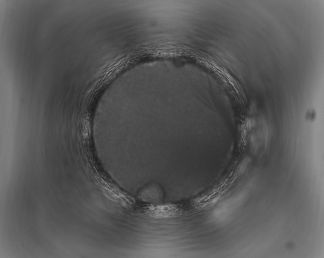 X0000094810517200712141625