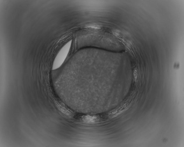 X0000094810570200712141625