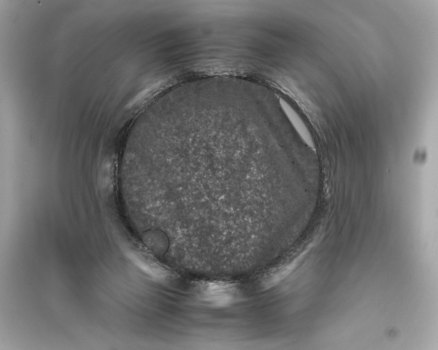 X0000094820165200711301637