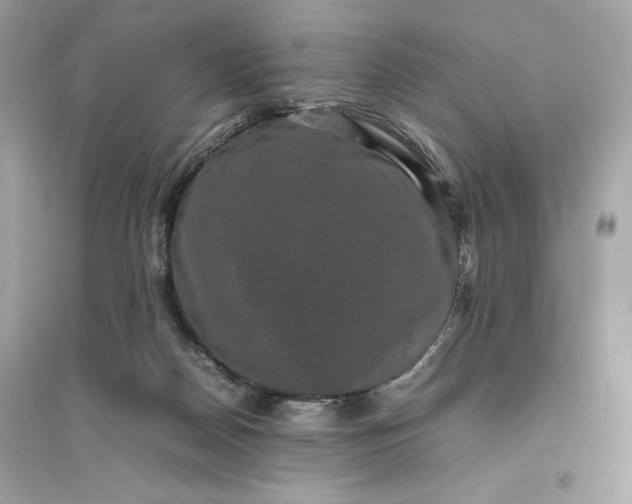 X0000094820170200711301637