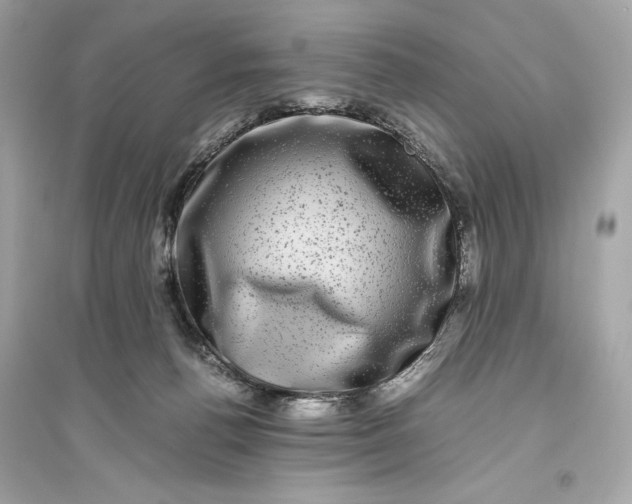 X0000094820176200711301638