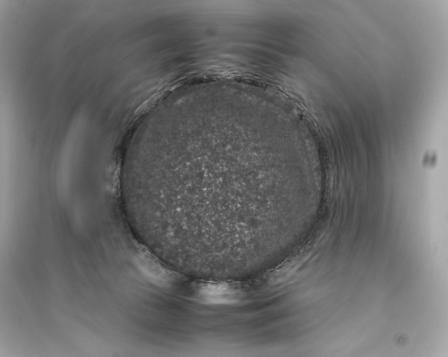 X0000094820177200711301638