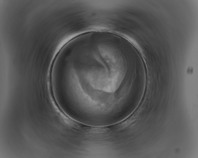 X0000094901440200711291222