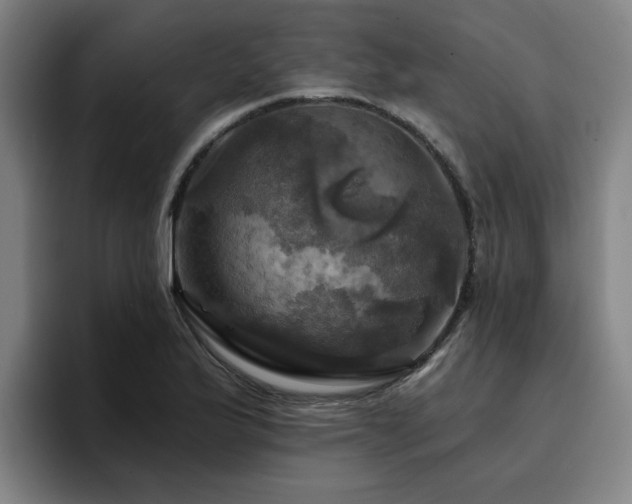 X0000094901175200712061022