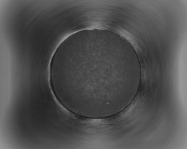 X0000094901479200712061018