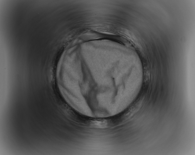 X0000094900317200712271457