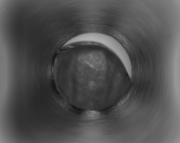 X0000094900429200712271456