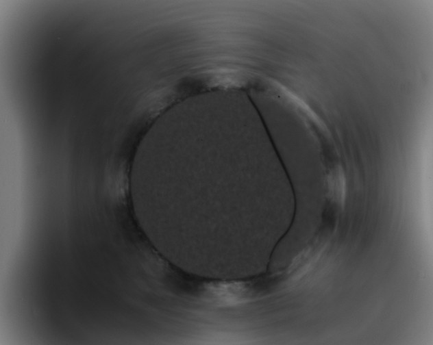 X0000094910517200712061051