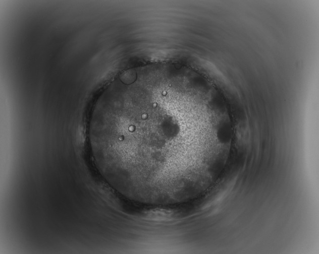 X0000094910691200712061049