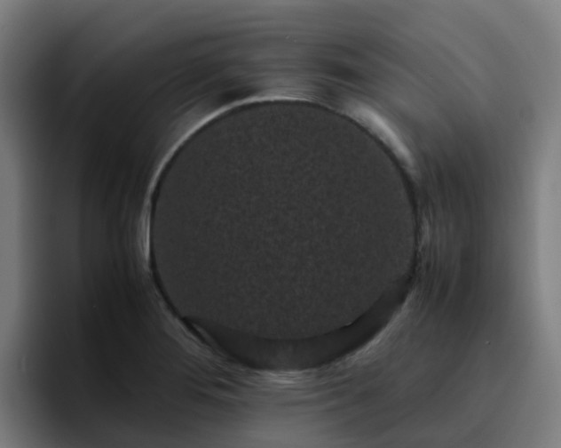 X0000094911276200712061041