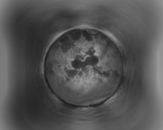 X0000094911279200712061041