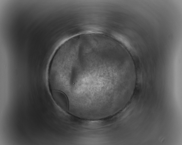 X0000094911471200712061039