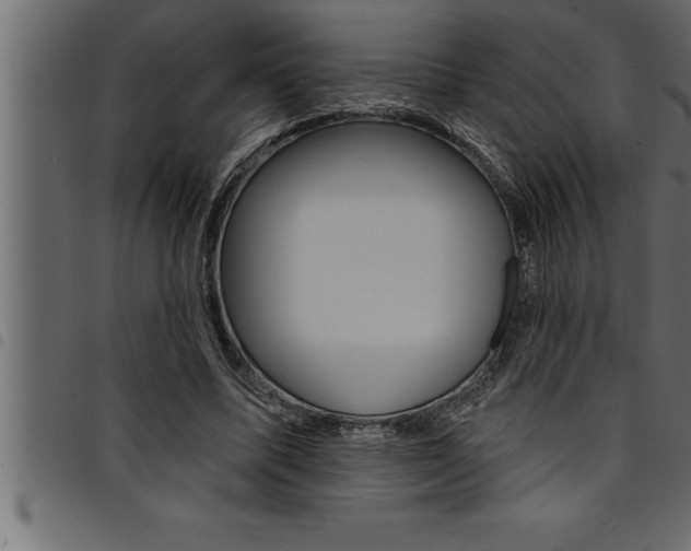 X0000094920587200711291024