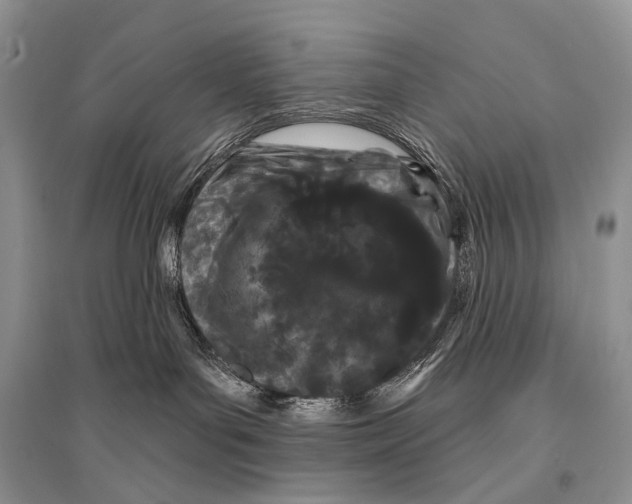 X0000094920143200712201228