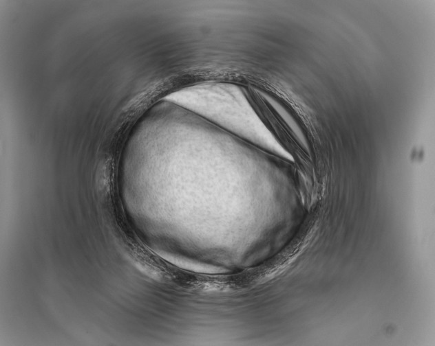 X0000094920165200712201228