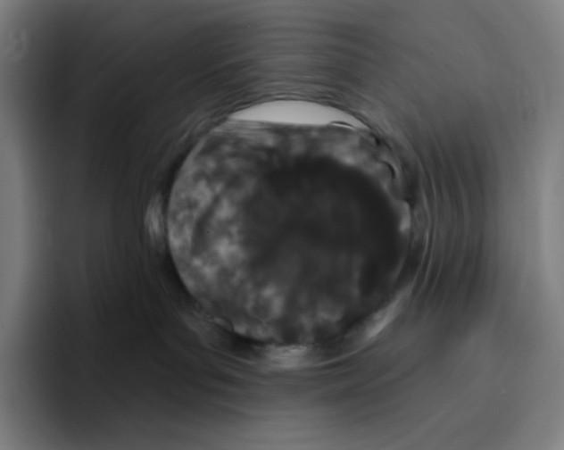 X0000094920143200712271540