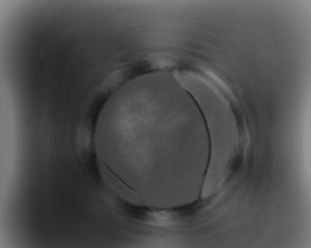 X0000094930417200712061133