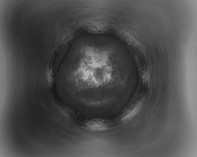 X0000094941156200712061225