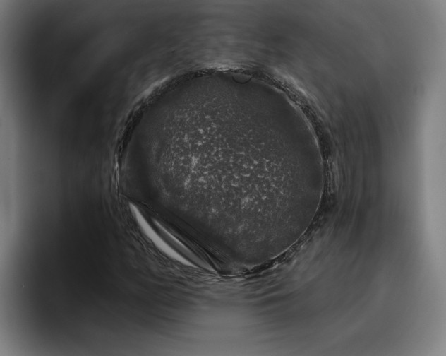 X0000094941158200712061225