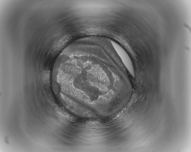 X0000094940066200712201124