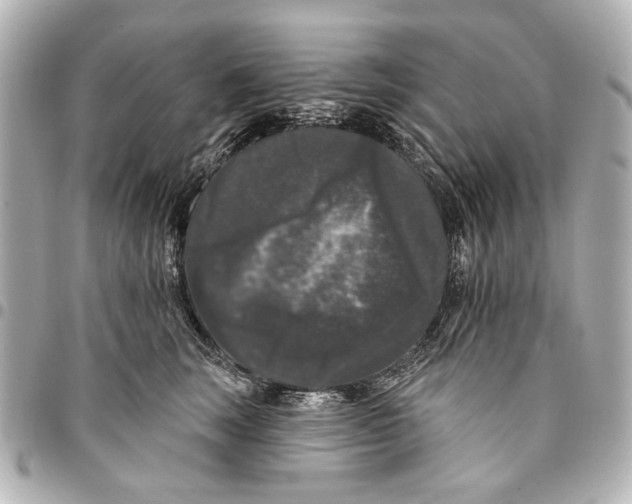 X0000094940663200712201116