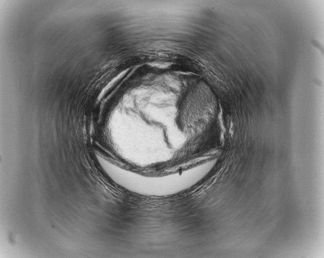 X0000094940771200712201114