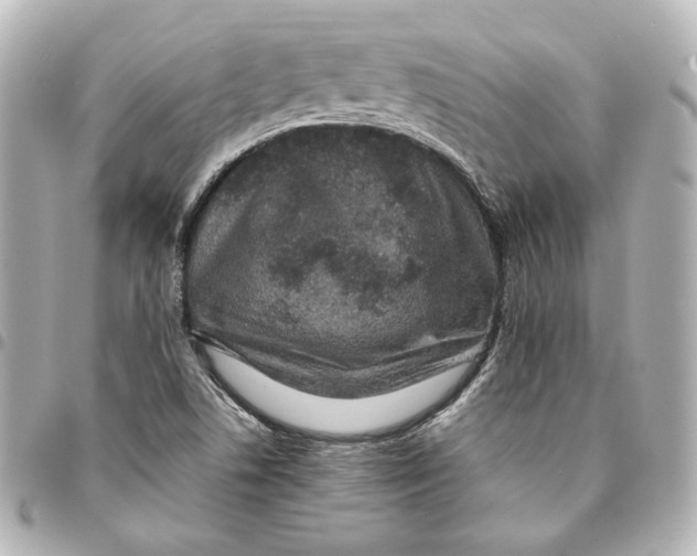 X0000094951506200712201125