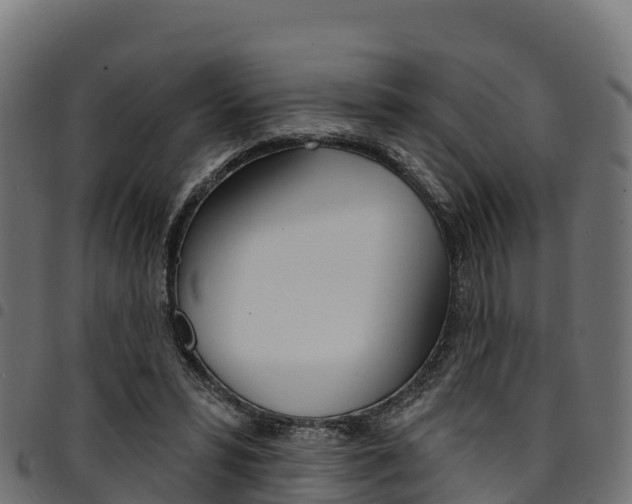 X0000094960399200711291132