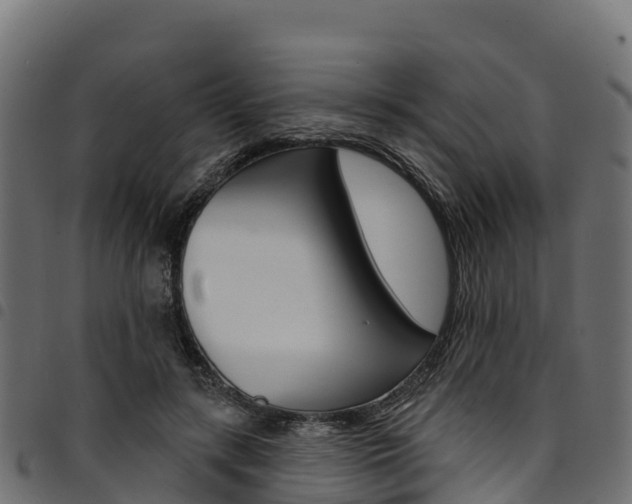 X0000094960547200711291130