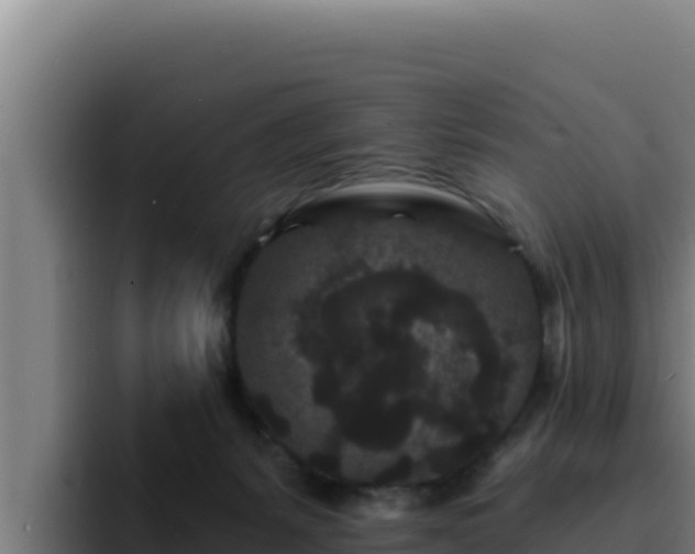 X0000094960127200712061319